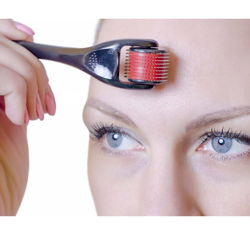 Alternative view of Nõelrull Derma Roller