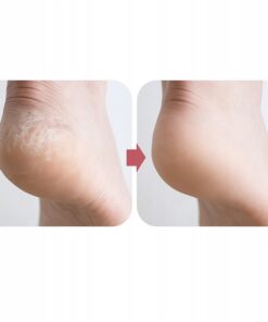 Alternative view of Nanoklaas nahahoolduskivi / kannariiv