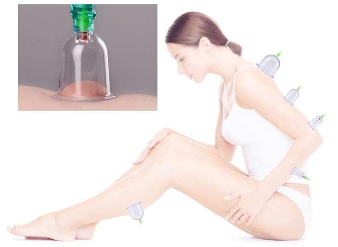 Vaakumkupud pumbaga komplekt – Soodukas.Com Vaakumkupud pumbaga komplekt - Image 9