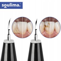 Ultraheli katueemaldaja / hambakivi eemaldaja Soodukas.Com