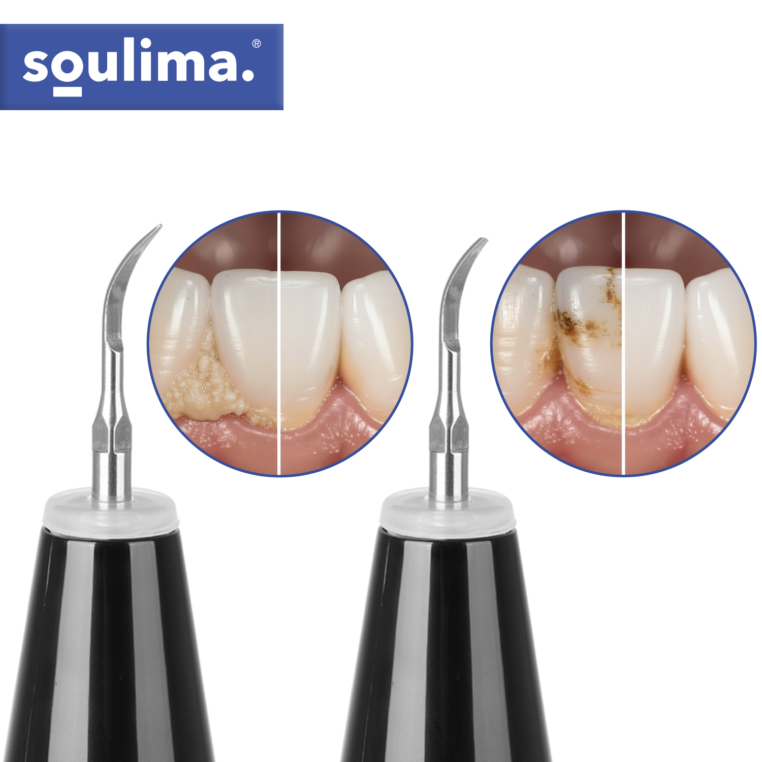 Ultraheli katueemaldaja / hambakivi eemaldaja – Soodukas.Com Ultraheli katueemaldaja / hambakivi eemaldaja - Image 12