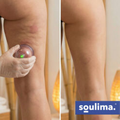 Vaakumkupud pumbaga 12tk Soodukas.Com