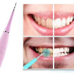 Ultraheli hammaste puhastamise seade – Soodukas.Com Ultraheli hammaste puhastamise seade Soodukas.Com