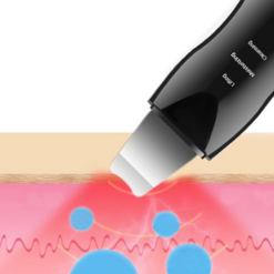 Näohoolduse ultraheli koorija Soodukas.Com