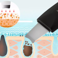 Näohoolduse ultraheli koorija Soodukas.Com