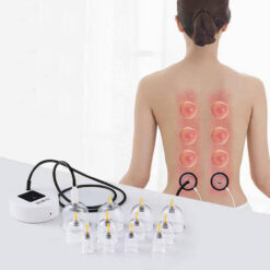 Elektilised vaakumkupud komplektis – Soodukas.Com Elektilised vaakumkupud komplektis Soodukas.Com