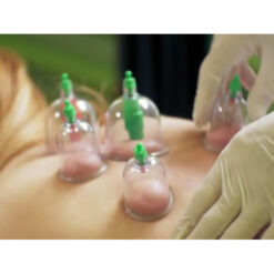 Elektilised vaakumkupud komplektis – Soodukas.Com Elektilised vaakumkupud komplektis Soodukas.Com